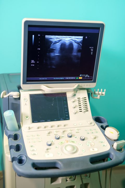 Změna ordinačních hodin - sonografie